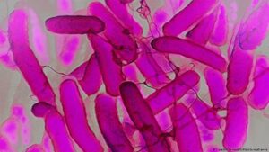 El raro síndrome intestinal que emborracha sin beber alcohol