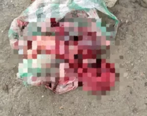 Hallan feto dentro de una bolsa en plena vía pública de La Isabelica