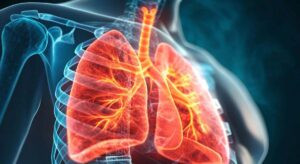 La estrategia que aumenta un 13% la supervivencia en cáncer de pulmón inicial no operable: «Es muy positiva»