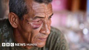 «Nunca pensé que me iban a atacar a mí»: hablan los sobrevivientes del ataque con misil al Bloque 12, el edificio donde murió una mujer durante el bombardeo de EE.UU. en Venezuela