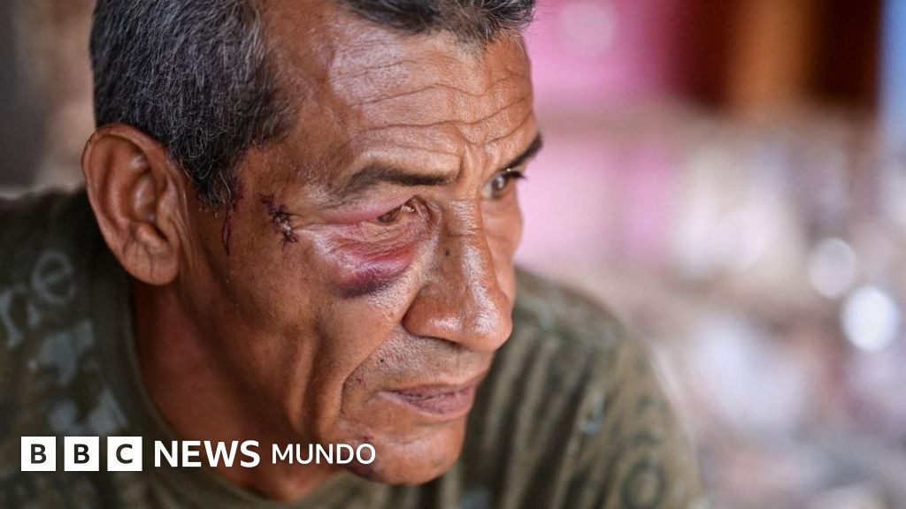 "Nunca pensé que me iban a atacar a mí": hablan los sobrevivientes del ataque con misil al Bloque 12, el edificio donde murió una mujer durante el bombardeo de EE.UU. en Venezuela