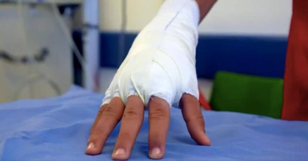 Pasto recibió el 2026 entre pólvora y caos: 48 personas resultaron lesionadas por quemaduras