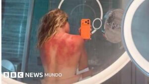Renata Zarazúa | La foto de una tenista mexicana que muestra el riesgo solar en el país con las tasas de cáncer de piel más altas del mundo
