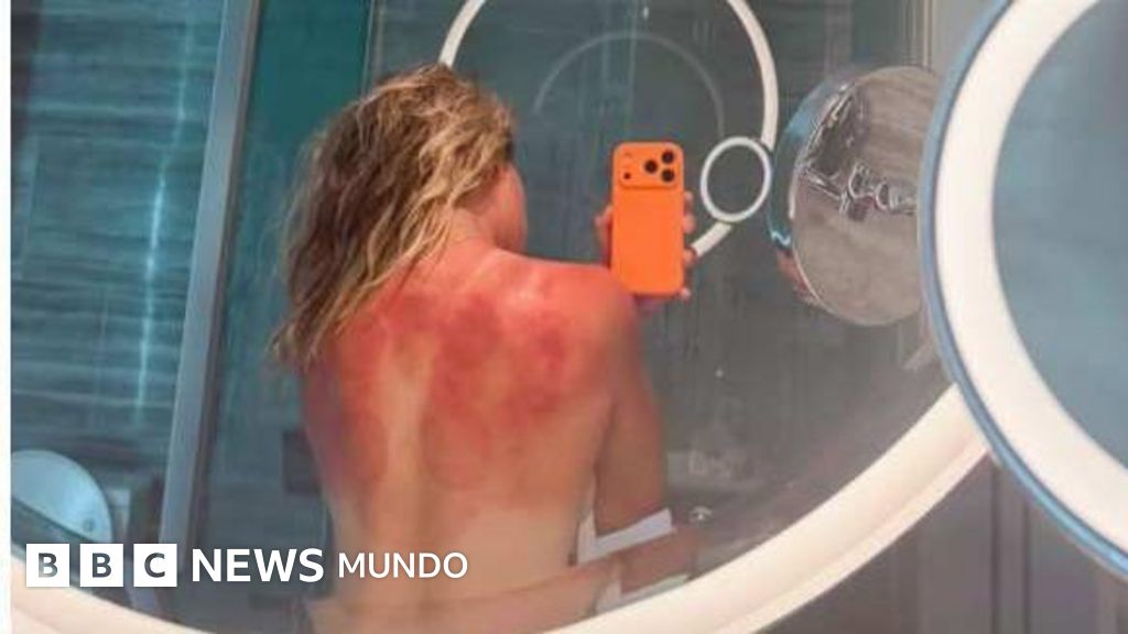 Renata Zarazúa | La foto de una tenista mexicana que muestra el riesgo solar en el país con las tasas de cáncer de piel más altas del mundo
