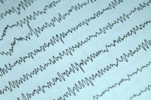 ¿Cuánta electricidad produce el cuerpo humano y cómo la genera?