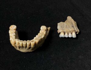 Los dientes humanos: el archivo biológico que revela nuestra historia evolutiva