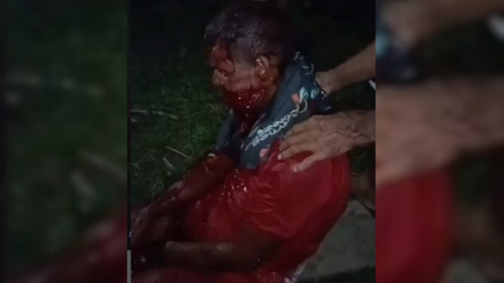 Puma atacó a un hombre en Carabobo