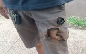Sufrió el ataque de dos perros en la calle y su teléfono le explotó en la pierna: “Fue peligroso, pero eso me salvó”