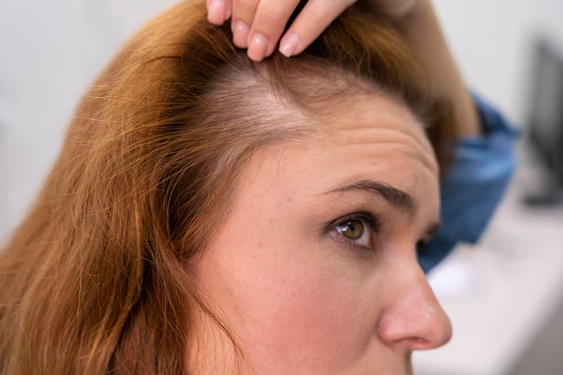 ¿Cómo envejece el cabello? Los factores que aceleran el deterioro capilar y las claves para prevenirlos