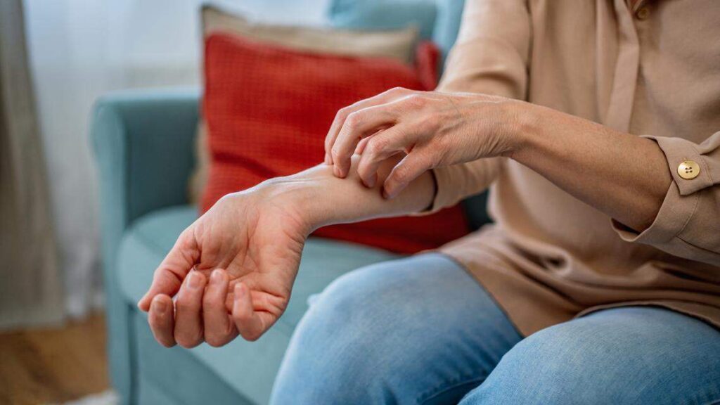 Científicos hallan que medicamento oncológico podría aliviar la psoriasis