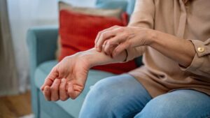 Científicos hallan que medicamento oncológico podría aliviar la psoriasis