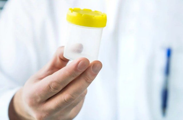 Detectan el primer caso de transmisión de una enfermedad rara mediante donante de esperma