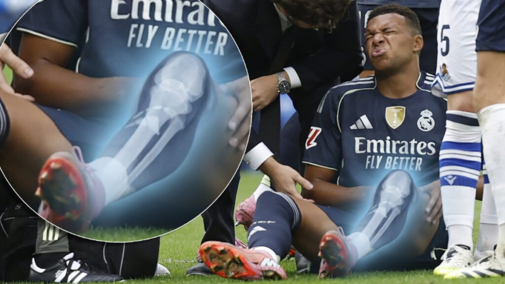 "El Real Madrid ha sido humillado y le ha pedido mentir a Mbappé sobre su lesión"