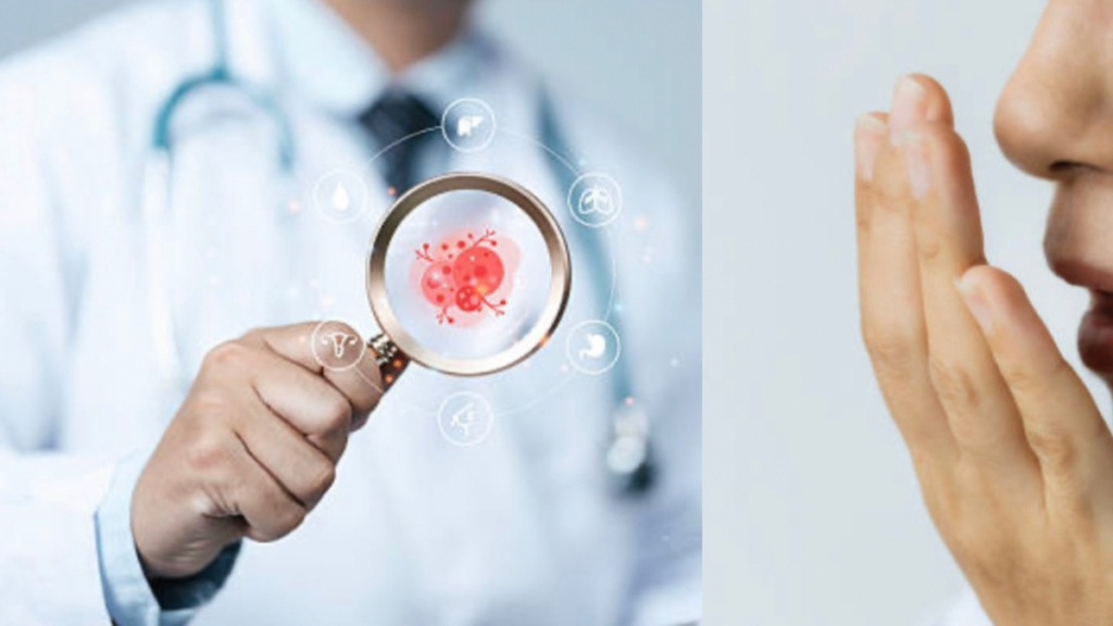 El tipo de cáncer que se puede detectar por el mal aliento