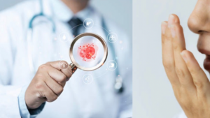El tipo de cáncer que se puede detectar por el mal aliento