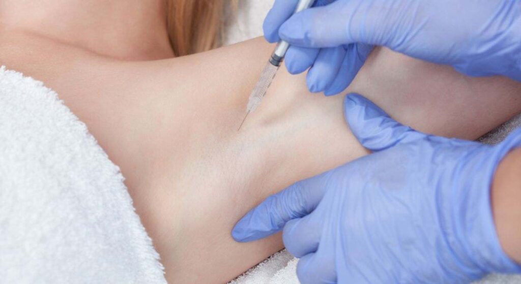 Si sufres sudoración excesiva, las microinyecciones de toxina botulínica pueden ayudarte a controlar la hiperhidrosis