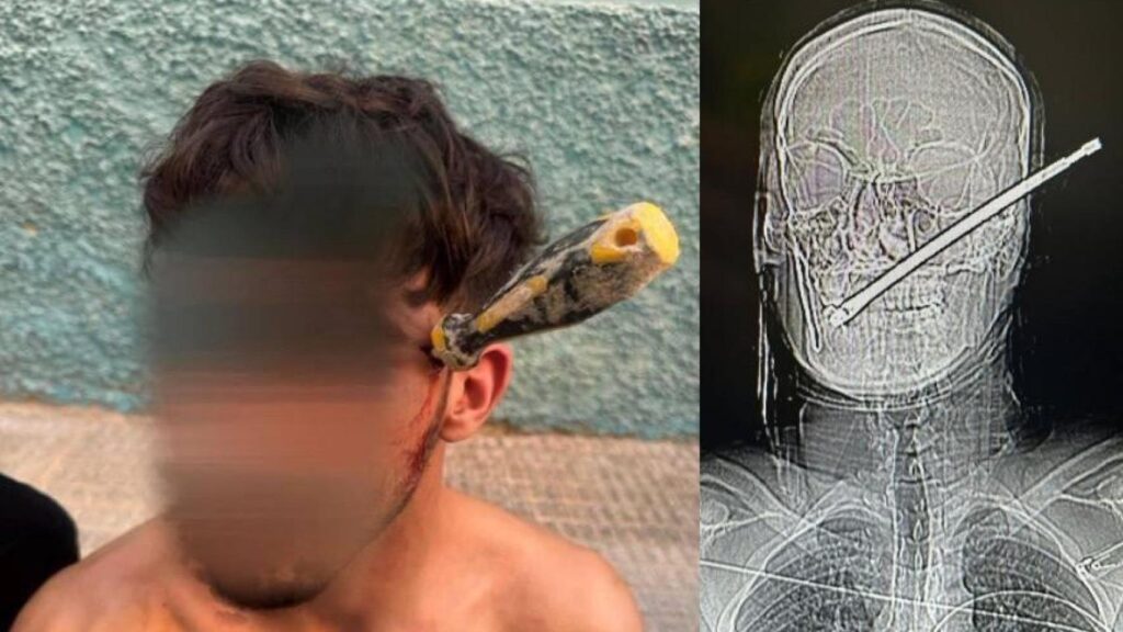 Sobrevivió después de que un joven le clavara un destornillador en la cabeza "para ajustar cuentas"