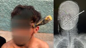 Sobrevivió después de que un joven le clavara un destornillador en la cabeza "para ajustar cuentas"