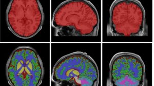 uno de los mapas más completos del cerebro humano