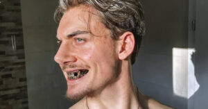 Chamo hace Looksmaxxing mascando chimó 6 veces al día para definir la mandíbula – El Chigüire Bipolar