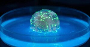 Científicos de Johns Hopkins cultivan 30 ‘mini-cerebros’ de pacientes para predecir la respuesta a fármacos contra el Alzheimer