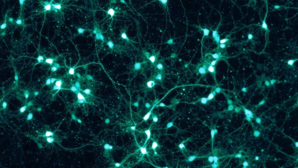 Dar nueva vida a neuronas para luchar contra el párkinson