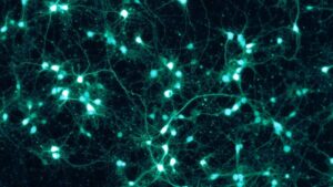 Dar nueva vida a neuronas para luchar contra el párkinson