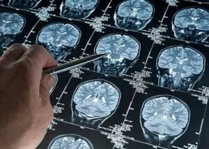 Desarrollan una plataforma que detecta el alzhéimer de forma precoz a través de la voz