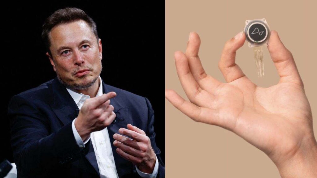 El chip en el cerebro de Elon Musk permite a un paciente de ELA volver a hablar después de cuatro años: