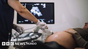 El extraño caso de una mujer que quedó embarazada de dos hombres al mismo tiempo que descubrió un grupo de científicos colombianos