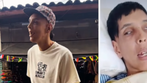 El hombre más alto de Colombia será operado tras sufrir una fractura de cadera: ‘Requiere materiales especiales’