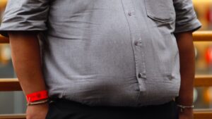 La obesidad afecta al sistema inmunitario incluso una década después de perder peso