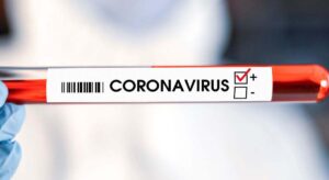 Los coronavirus no utilizan una sola puerta de entrada: descubren un nuevo mecanismo para infectar células humanas