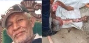 Muere adulto mayor tras recibir descarga eléctrica