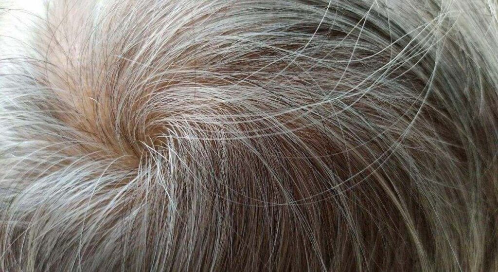Para qué sirve aplicar vinagre de manzana en las canas y cómo hacerlo correctamente