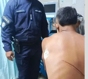 Poliguacara busca a El Yuquita’ tras machetear a un hombre