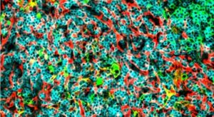 Científicos descubren dos moléculas con potencial para combatir un tipo de leucemia muy agresiva