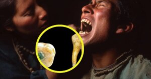 Hallan el primer empaste de jade del mundo maya: un molar precolombino de 500 años reescribe la historia de la odontología precolombina