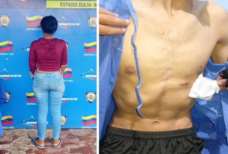 La detuvieron por apuñalar a su pareja en el pecho