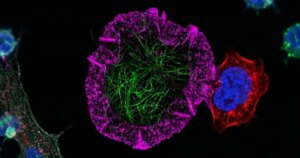 La imagen que nadie había podido obtener: los linfocitos T cazando células cancerosas en 3D y casi en vivo