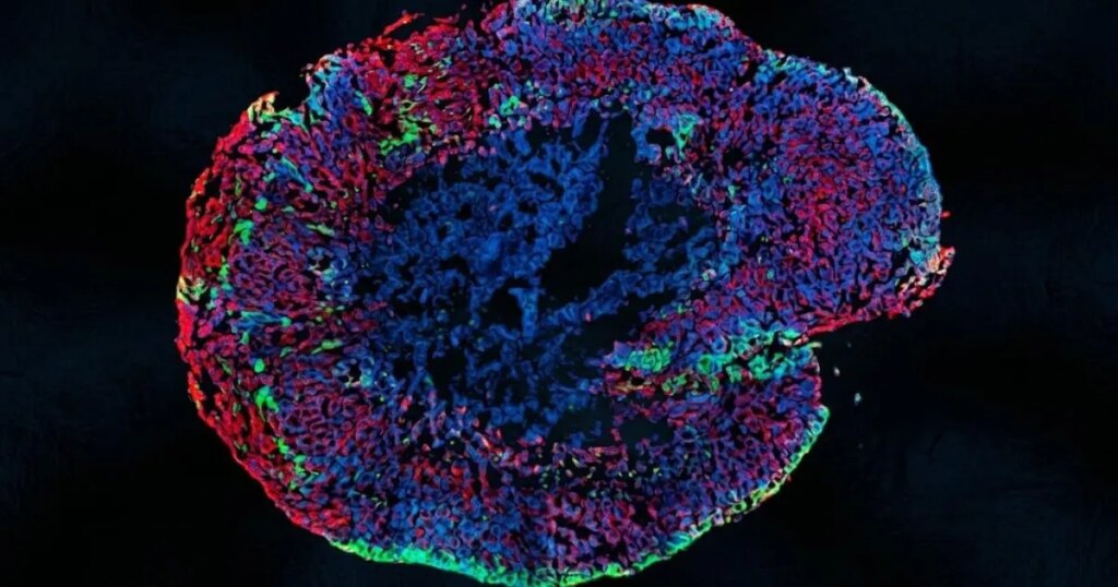 Las neuronas humanas saben reparar lesiones nerviosas, pero lo olvidan en un momento exacto del desarrollo
