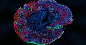 Las neuronas humanas saben reparar lesiones nerviosas, pero lo olvidan en un momento exacto del desarrollo