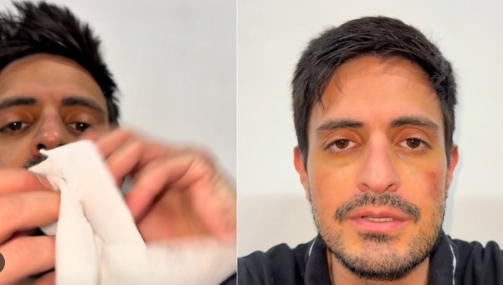 Michelo reaparece golpeado y habla de traidores (VIDEO)