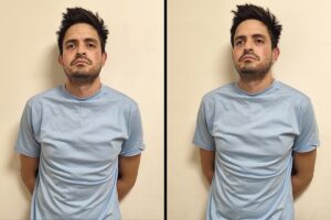 Michelo reapareció golpeado y con orden de expulsión: los VIDEOS del influencer hospitalizado en clínica de Caracas