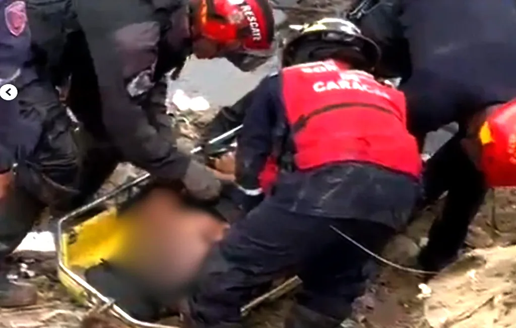 Abuela sufrió quemaduras graves al manipular gasolina en Moron