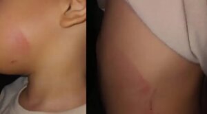 Arrestan a una abuela por causar moretones a correazos a su nieto