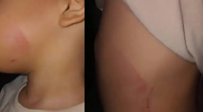 Arrestan a una abuela por causar moretones a correazos a su nieto