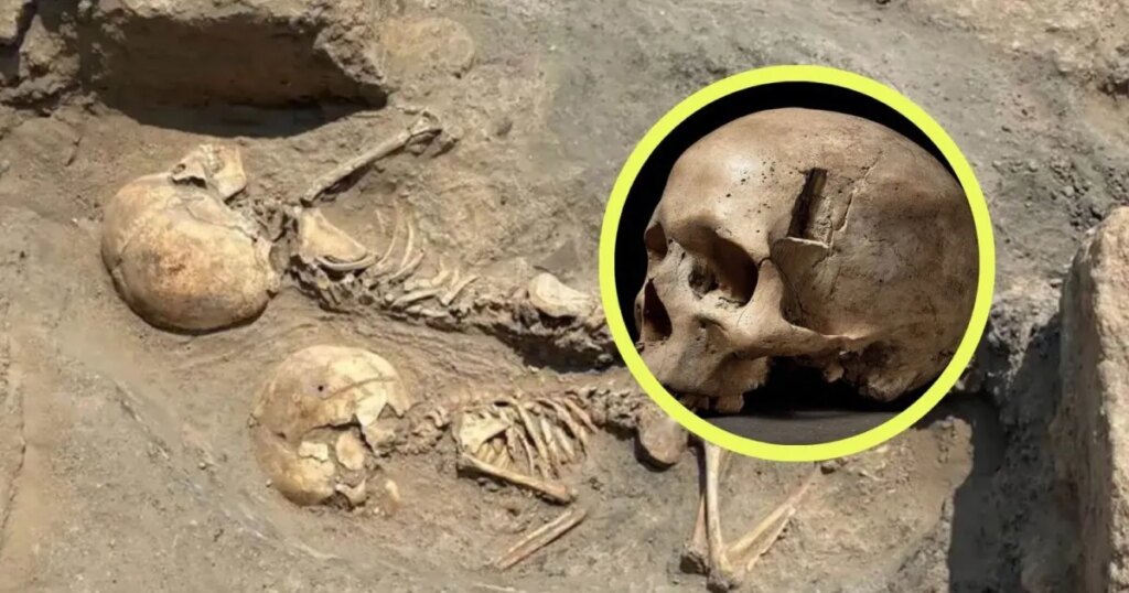 Descubren en Uzbekistán la cirugía más antigua conocida de Asia Central: un caso de 4.000 años que tiene como protagonista a un niño