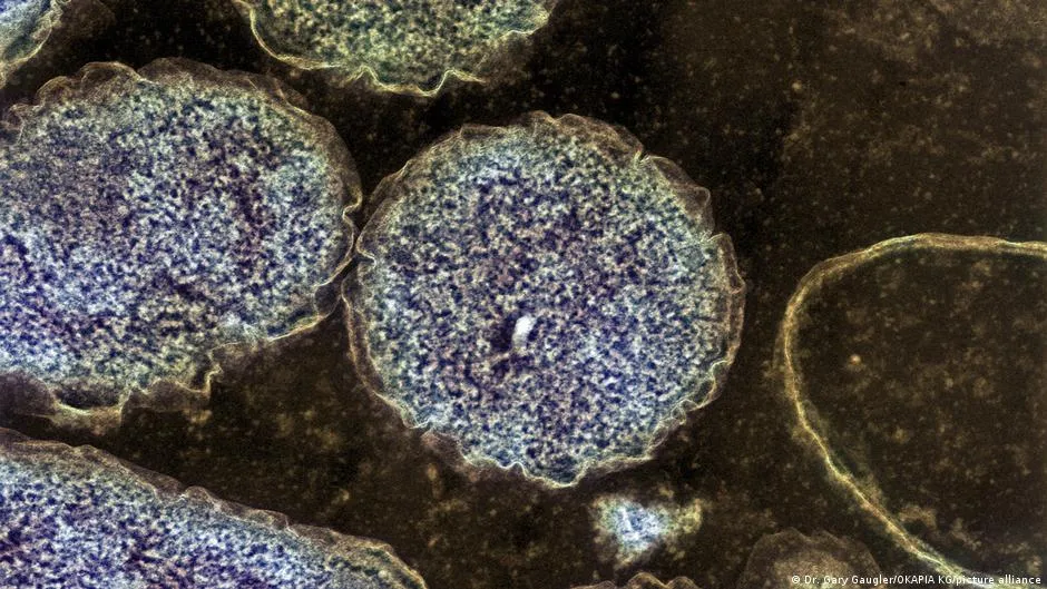 Descubren prometedor compuesto contra bacterias resistentes