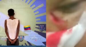 Desfigura el rostro a su sobrina de 16 años por un plato de arroz